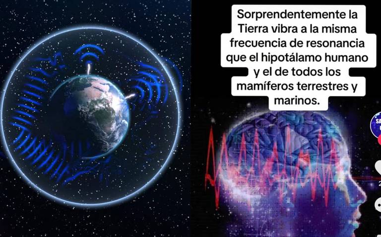 RESONANCIA SCHUMANN - IMAGEN